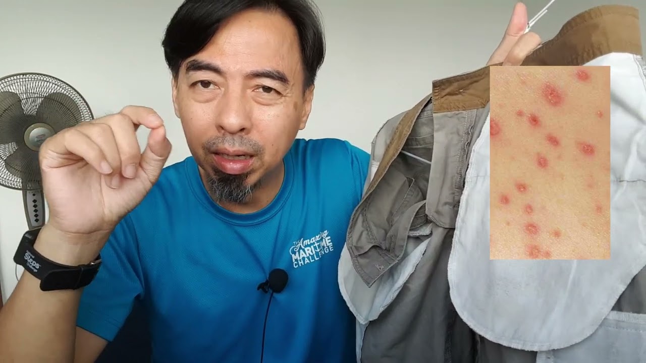 Beware of Cloth Mold in Your Clothing