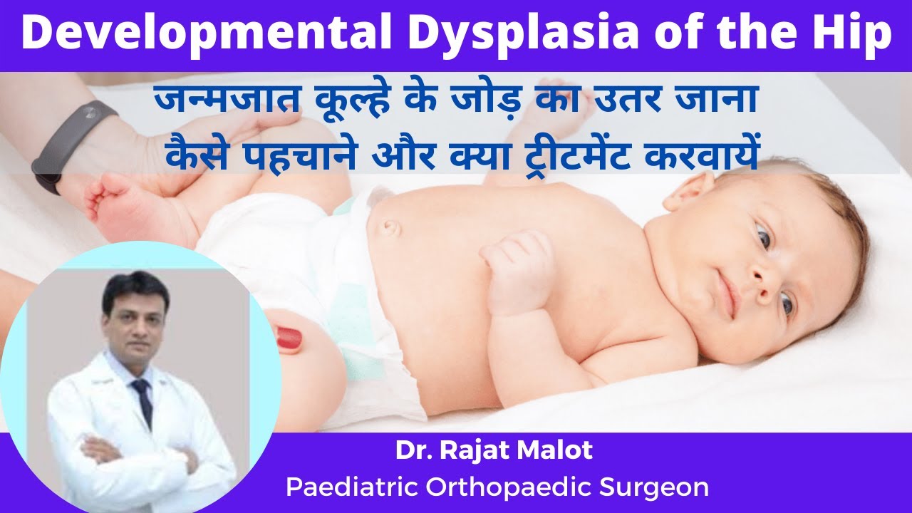 Congenital Hip Dislocation (जन्मजात कूल्हे के जोड़ का उतर जाना) Developmental Dysplasia of the Hip