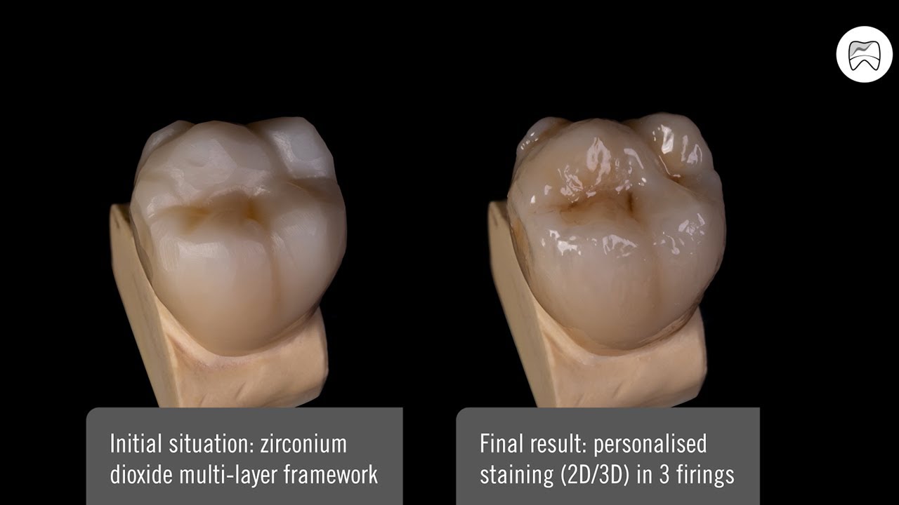 HeraCeram cre-active - Tutorial - Personalised Staining of posterior case