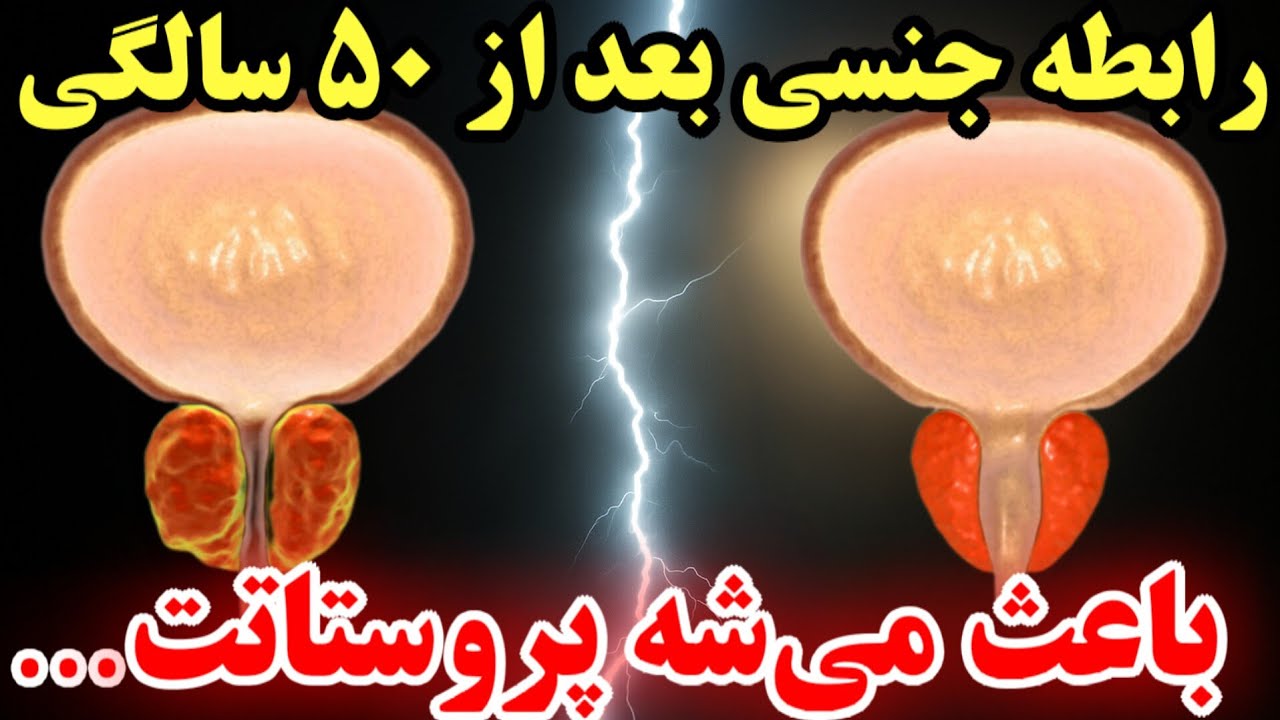 متخصص پروستات التماس می‌کند: این ۵ عادت را بعد ۵۰ سالگی هر روز انجام  دهید_اثر رابطه جنسی بر پروستات