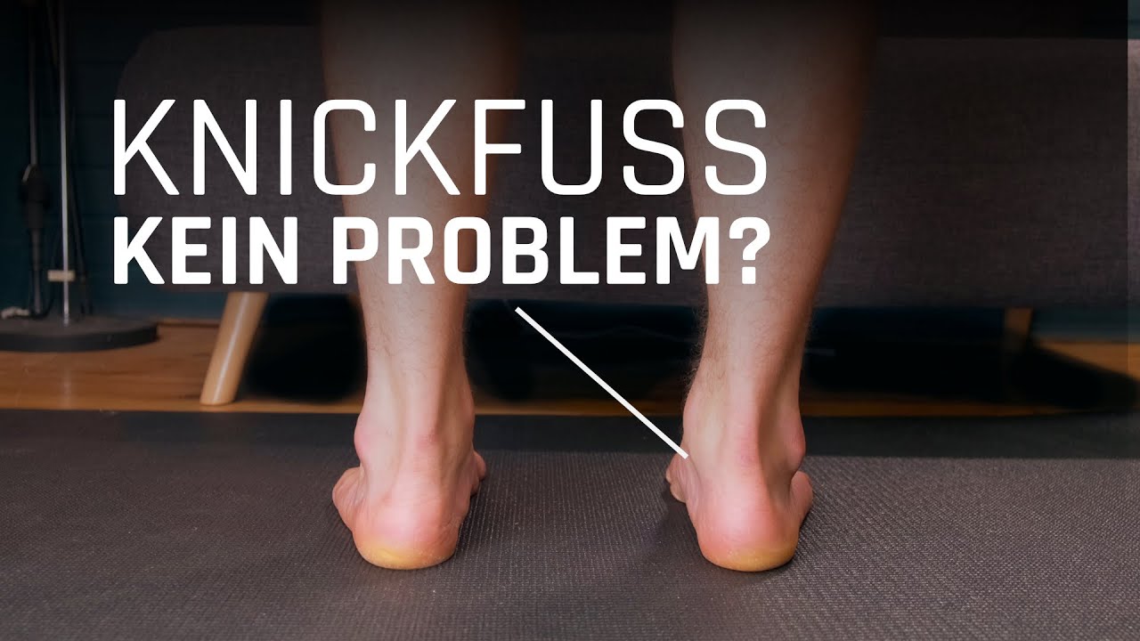 Das KNICKFUSS-GEHEIMNIS: Sind Knickfüße wirklich ein Problem?