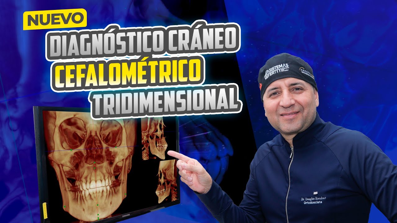 DIAGNÓSTICO CRÁNEO CEFALOMÉTRICO TRIDIMENSIONAL (3D)