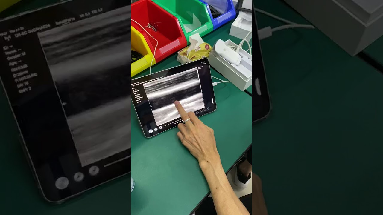 BIO-W6 wireless color probe with dual heads convex + linear