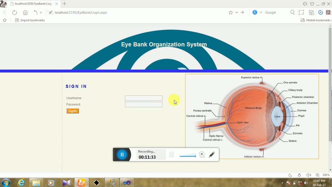 eyebank