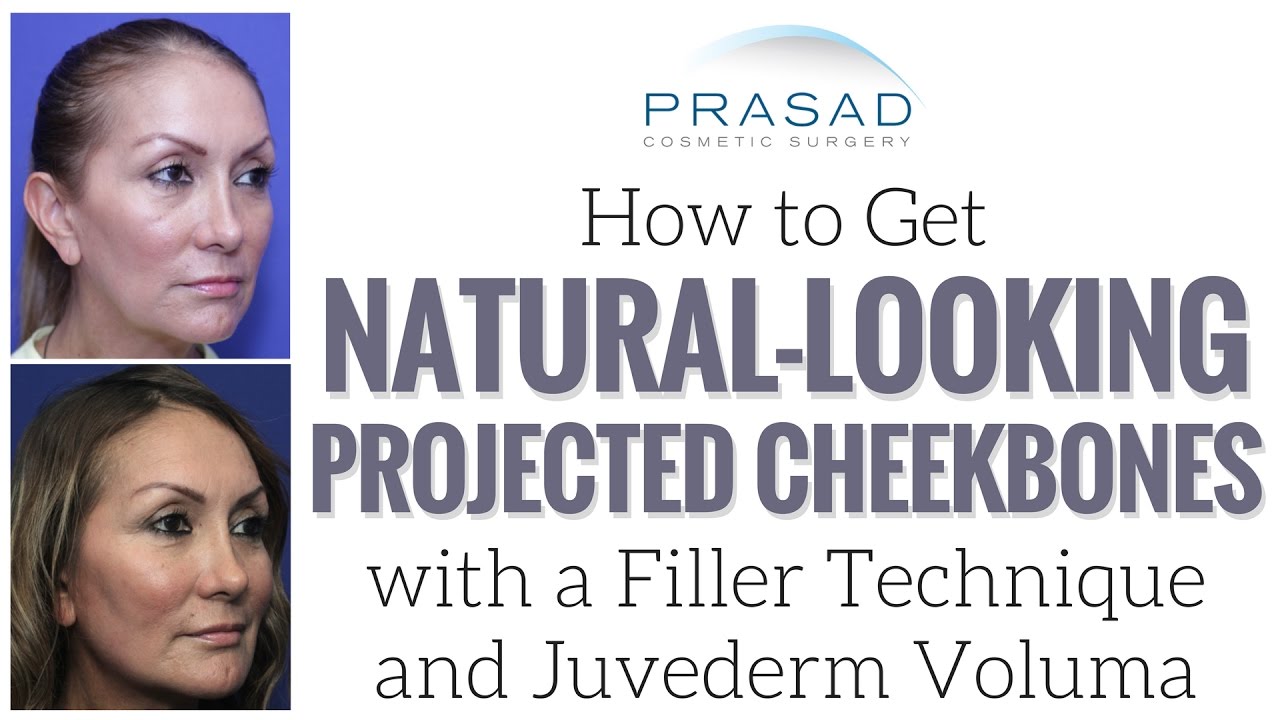 How to Get Projected, Natural-Looking Cheekbones with Deep Placement of Cosmetic Filler