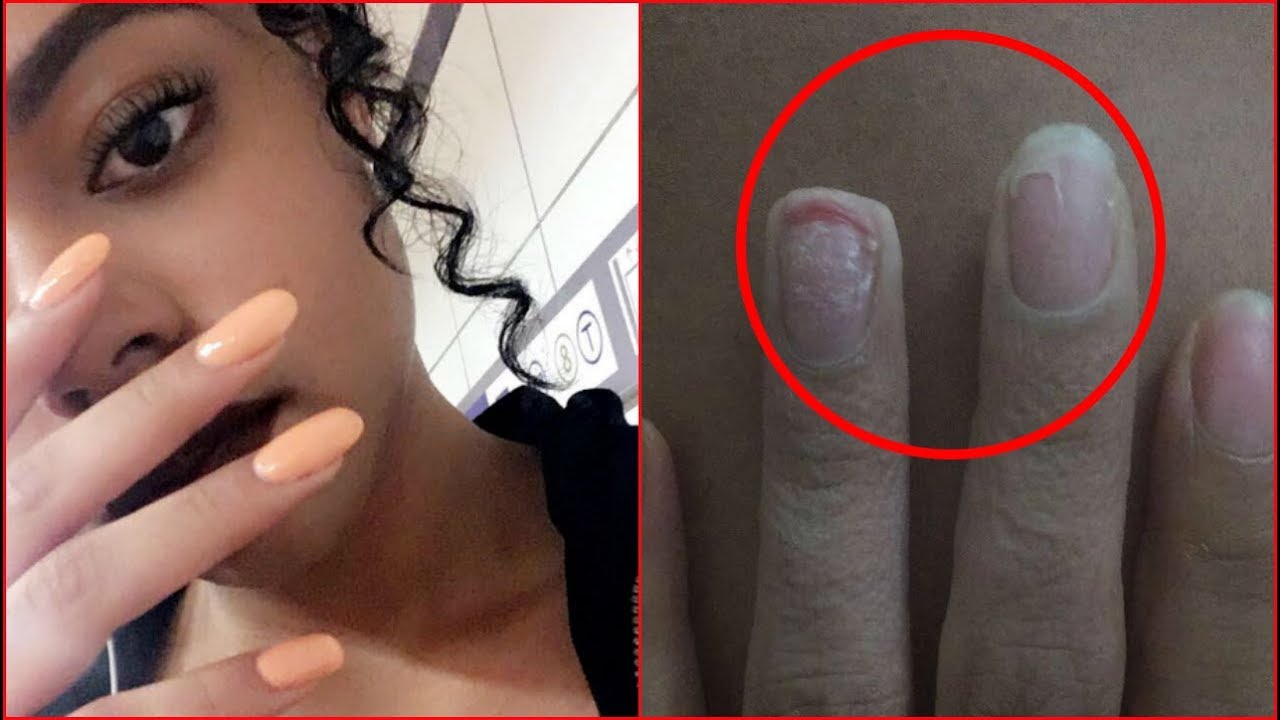 Pourquoi j'ai arrêté les faux ongles... (Story et conseils)