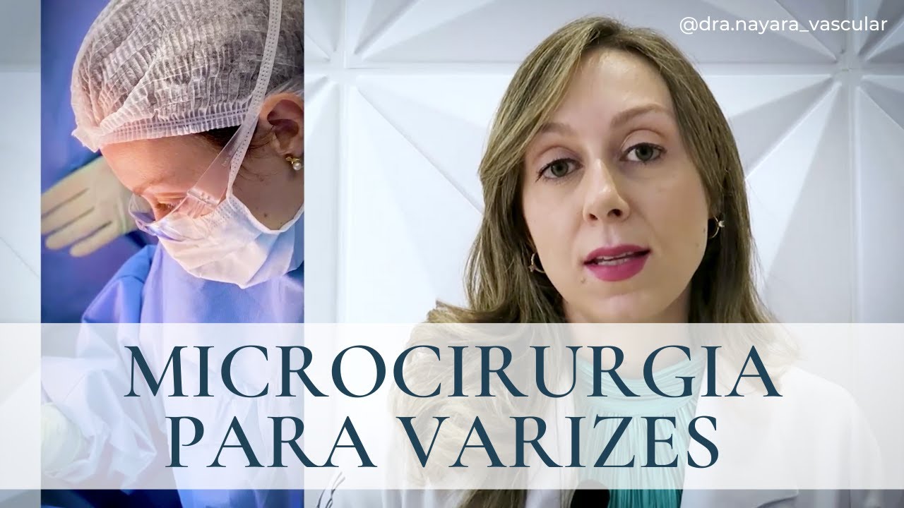 Microcirurgia para Varizes - Dra. Nayara Cioffi Batagini - Cirurgiã Vascular e Endovascular