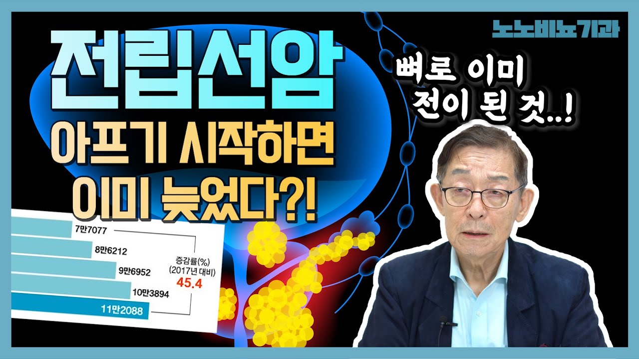 아프기 시작하면 이미 늦었다는 전립선암! 최근 급증한 이유는?!! - 노노비뇨기과 EP.17