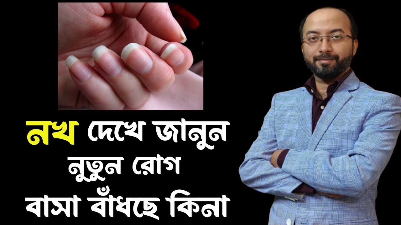 নখ দেখে জানুন শরীরে কোনো রোগ বাসা বেঁধেছে কিনা | নখ দেখে রোগ চেনার উপায় | Nail problem solution
