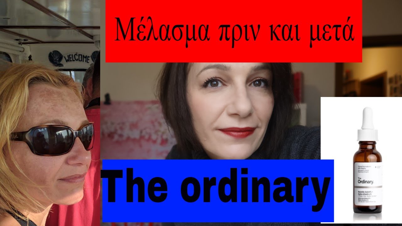 Oι καλύτερες Επιλογές για πανάδες απο #The ordinary, #melasmatreatment