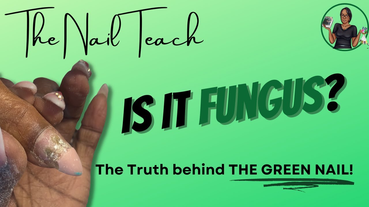 IS IT NAIL FUNGUS? | How to deal with THE GREEN NAIL | Nail Education | The Nail Teach | KeishaNails