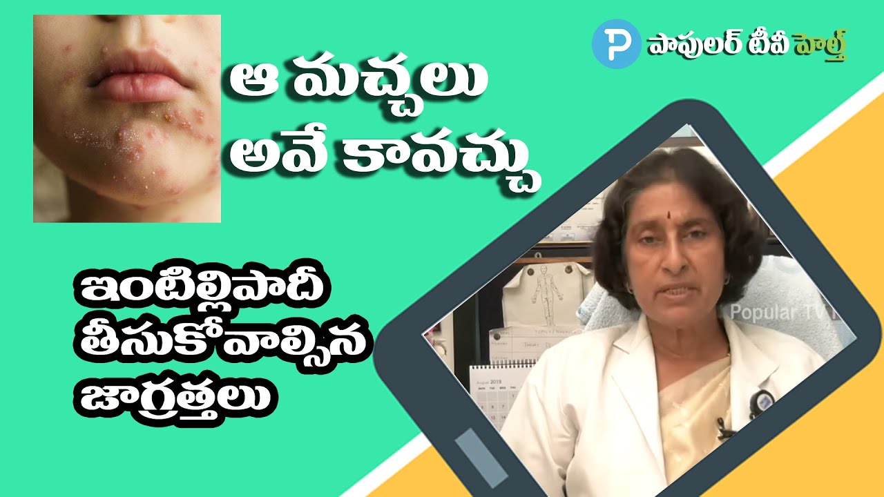Fungal Skin Infection తామర చర్మ సమస్య Treatment,  Symptoms Explained Dr Chandravathi Dermatologist