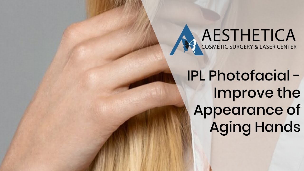 IPL Photofacial - Improve the Appearance of Aging hands - Phillip Chang M.D. - www.gotobeauty.com