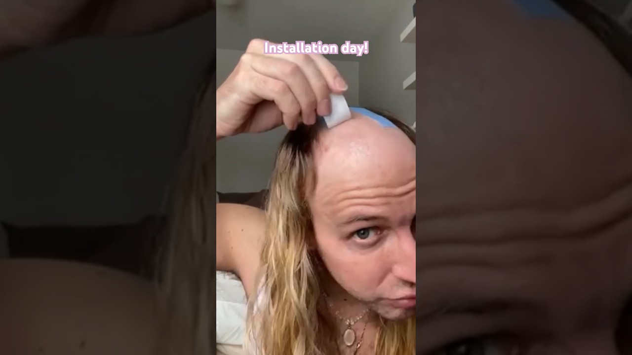INCREDIBLE before and after. Did you expect that? 😮 #shorts  #hairsystem #transformation