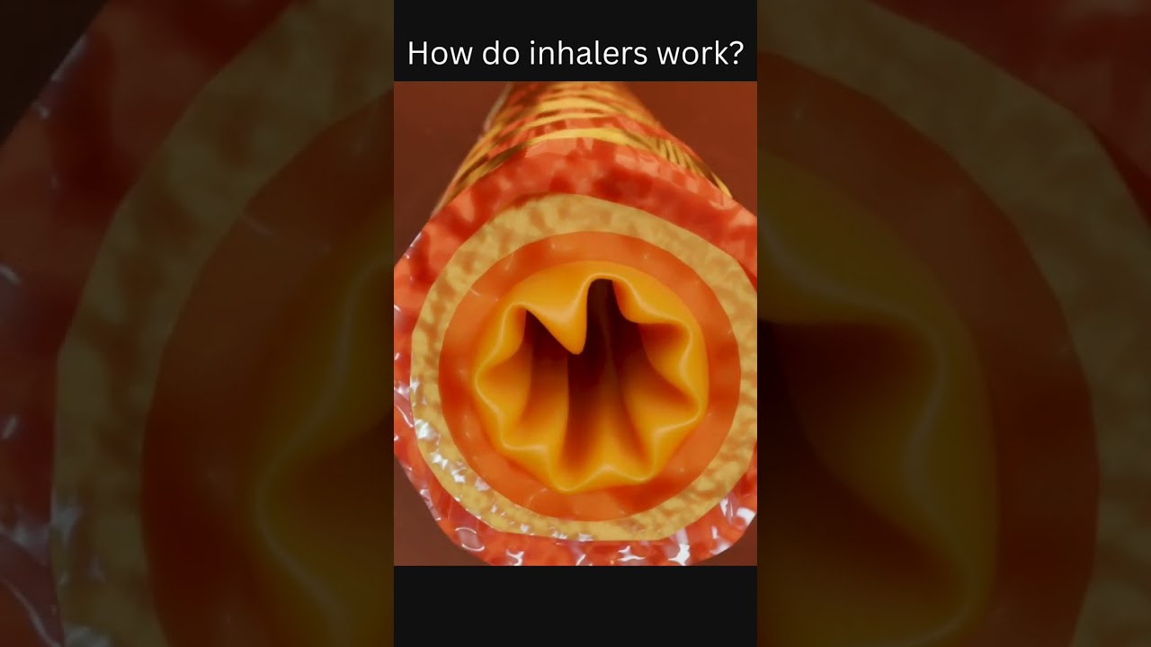 How do inhalers work?.