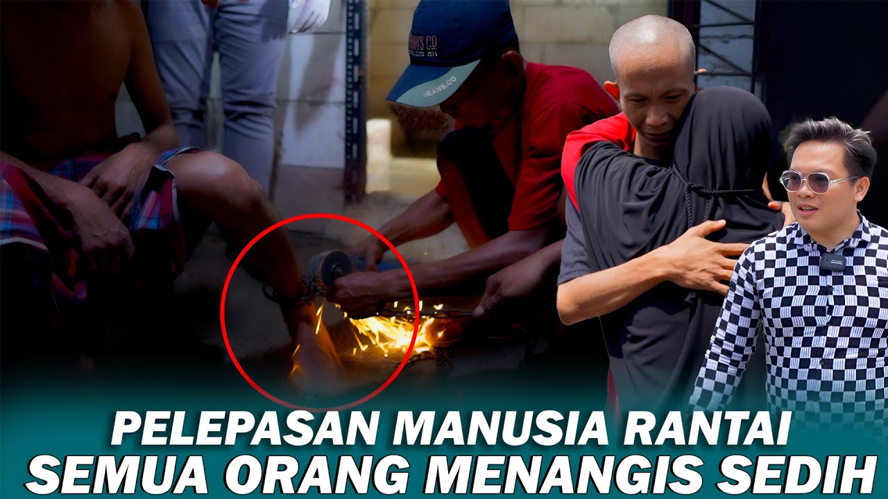 KAKI ODGJ TERPAKSA DI GERINDA AKIBAT SUDAH TERLALU LAMA DIPASUNG RANTAI