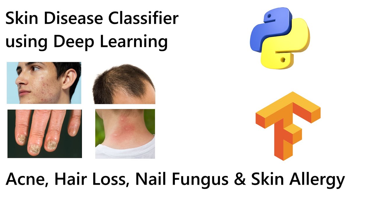 🚀 Deep Learning for Skin Disease Classification | Train a VGG19 Model Step-by-Step