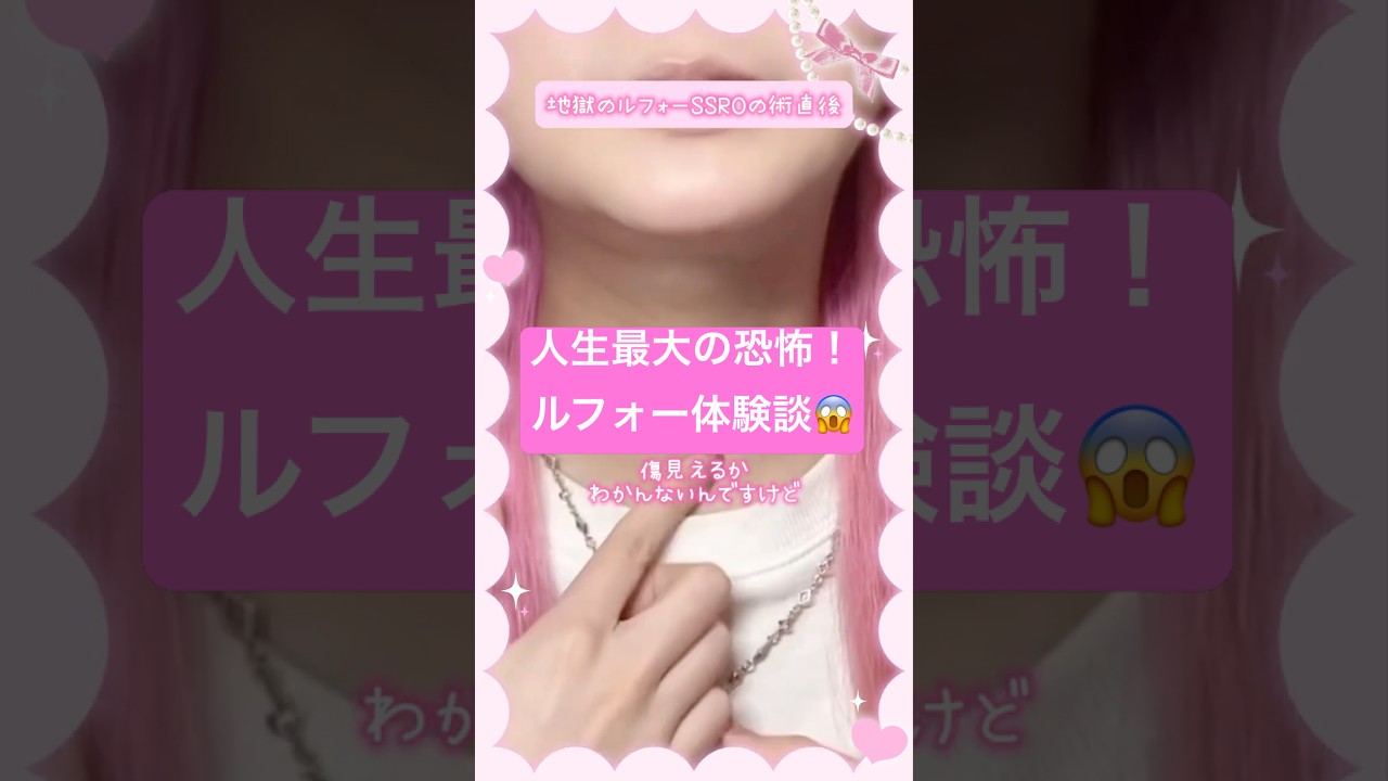 人生最大の恐怖体験、ルフォーの術直後の様子について💀　#整形 #美容整形 #骨切り #ルフォー #両顎手術