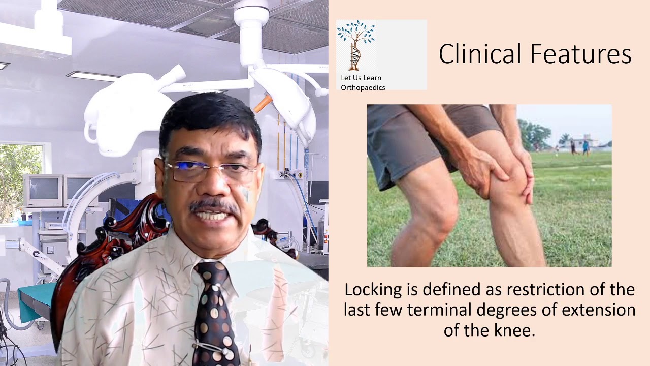 Let Us Learn Orthopaedics- Injuries of Semilunar Cartilages of Knee