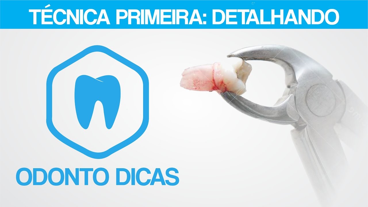 T&Eacute;CNICA PRIMEIRA: DETALHANDO | ODONTO DICAS