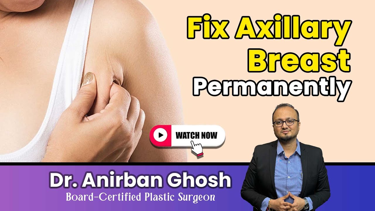 Axillary Breast Removal | Armpit Breast Surgery Explained | Safe & Quick Treatment in India