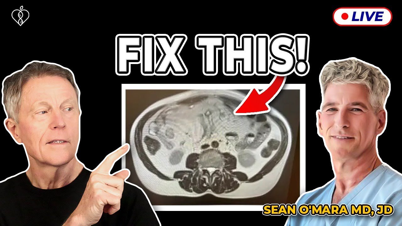 Dr Sean O'Mara: Do This To Reverse Visceral Fat