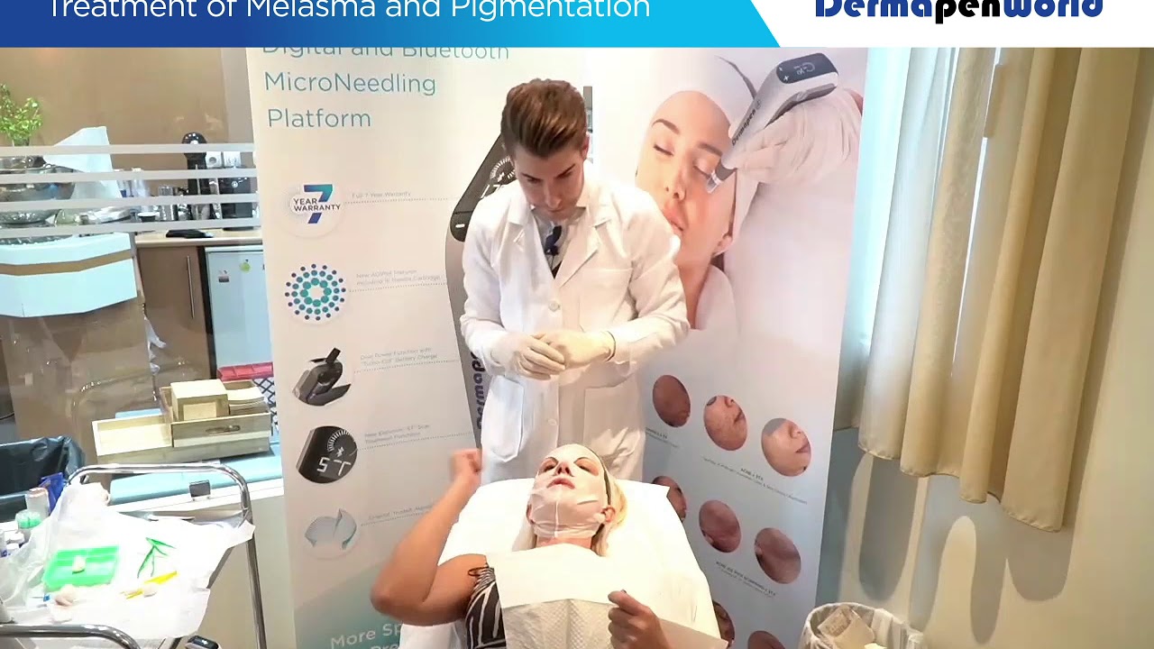 Dermapen 4 Treatment Melasma