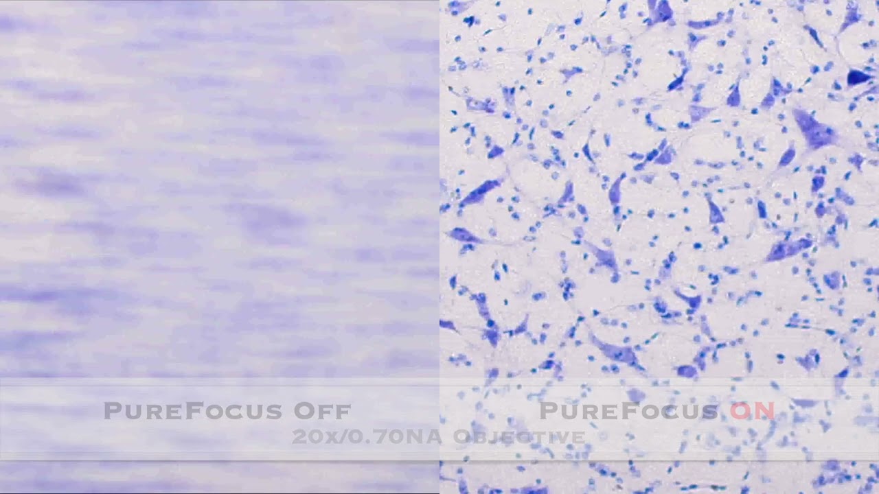 PureFocus Laser Autofocus System for biological application