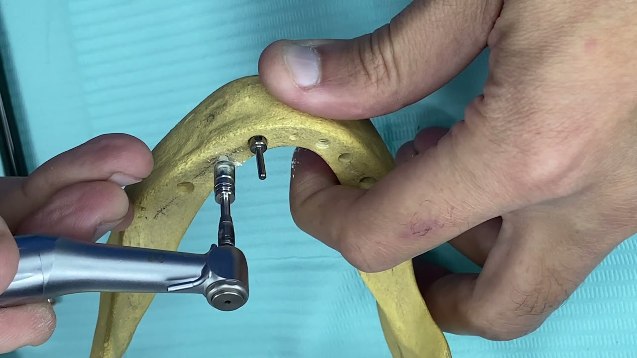 WORKSHOP |04| Dental Implant Installation Protocol