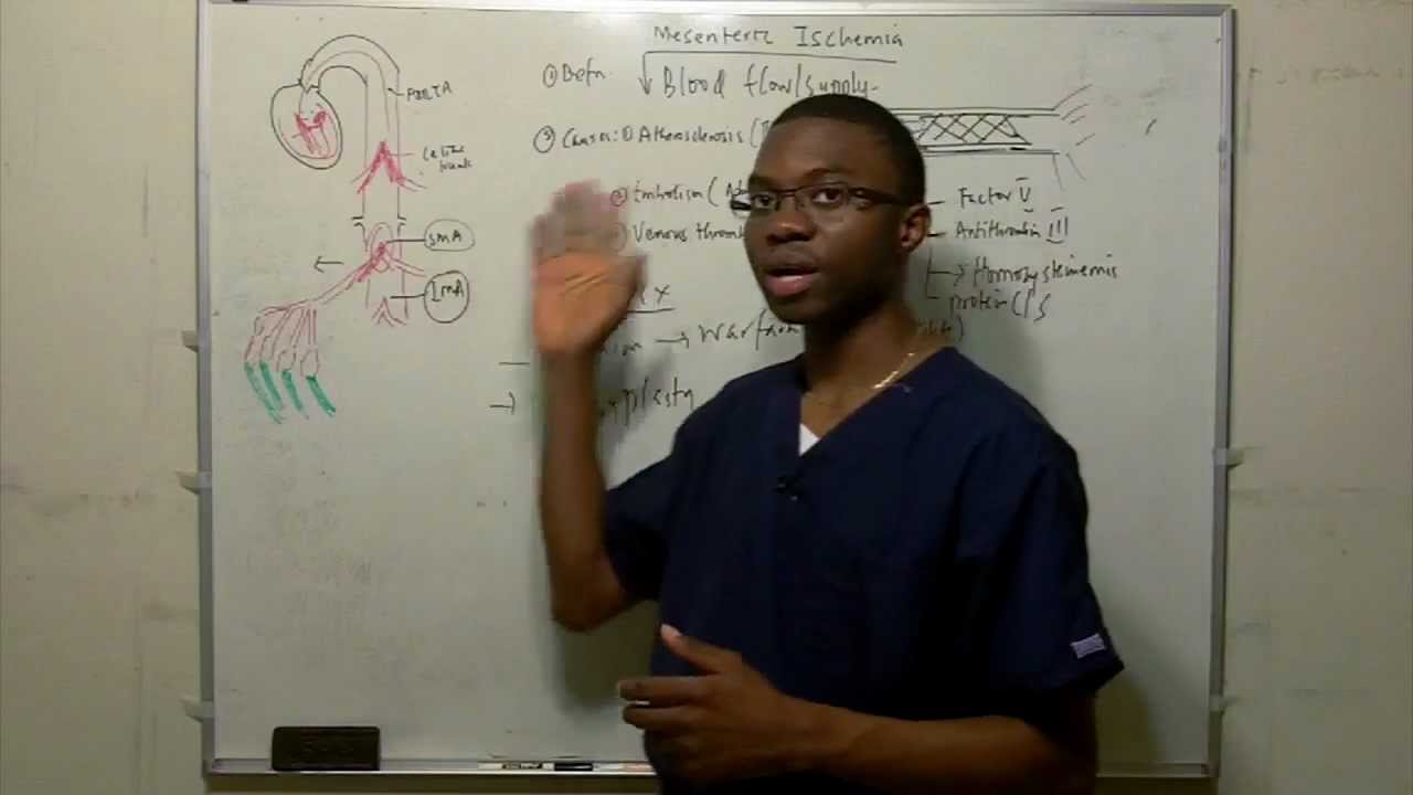 Mesenteric Ischemia Lecture  in HD!