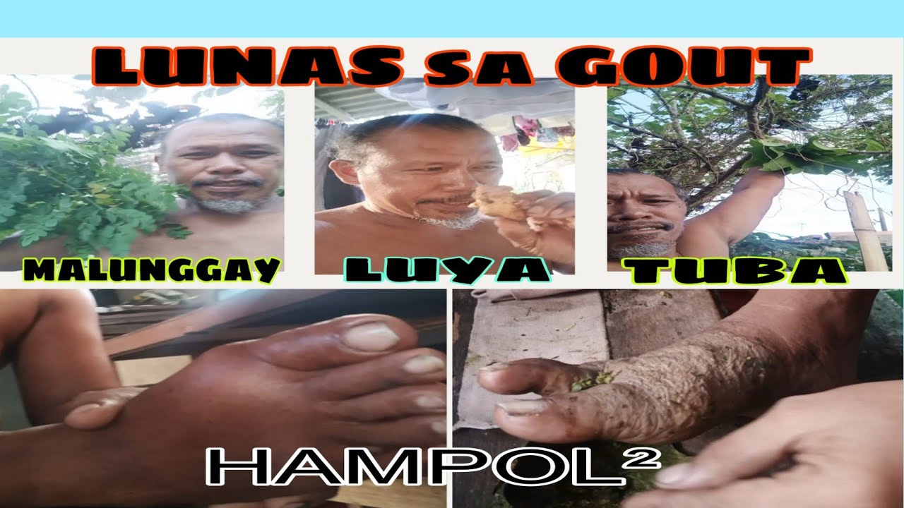 PAANO LABANAN ANG PAMAMAGA at KIROT na DULOT nang GOUT o ARTHRITIS 😲😱