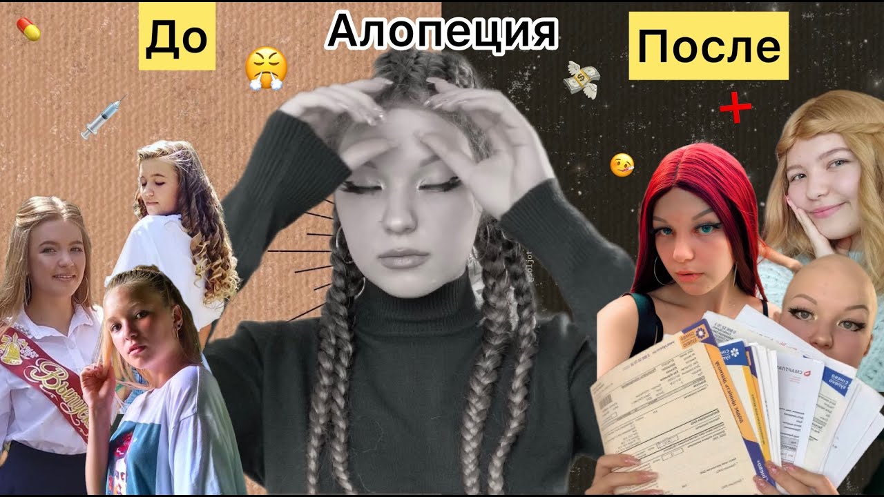 Облысела в 12 лет || моя 