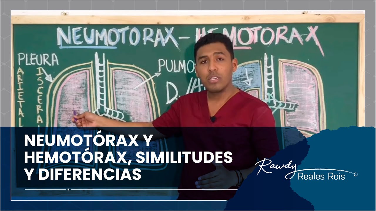 NEUMOTORAX Y HEMOTORAX | DR RAWDY