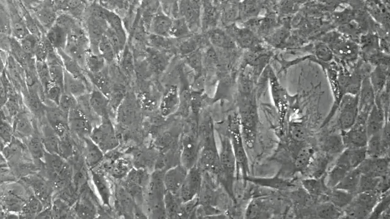 Bone Hormone Improves Memory in Old Mice
