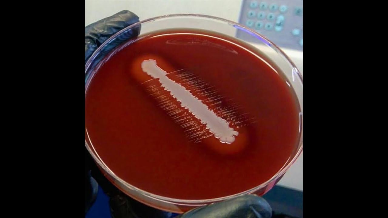 Haemophilus. Candida parapsilosis. Пятничные кейсы!