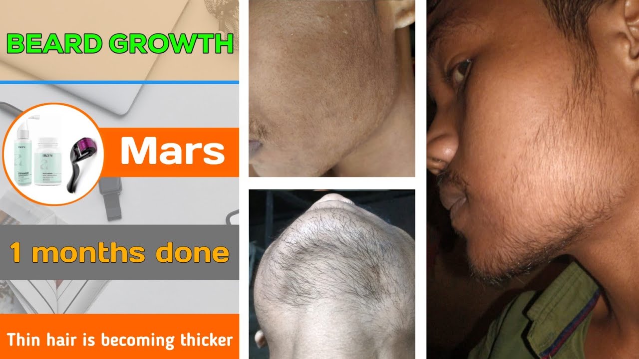 BEARD GROWTH ! 1 months done ✔️ Thin hair is becoming thicker ! How to grow a beard 