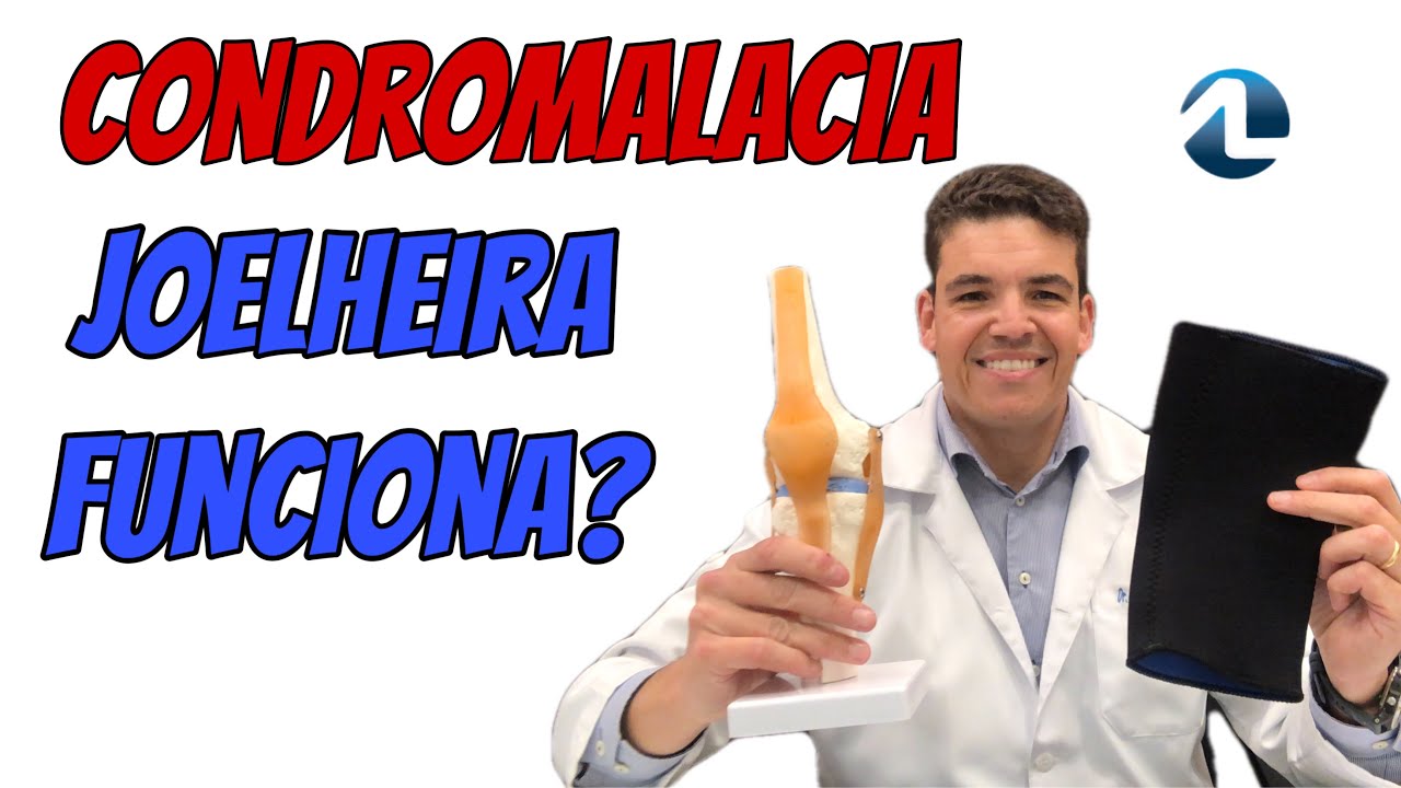 Condromalacia patelar: usar joelheira funciona?