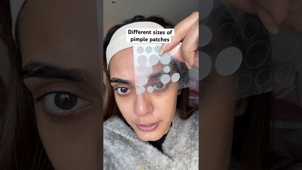The *BEST PIMPLE PATCH*🤯 pimple gone in JUST *8 hours* 😱😨 #skincare