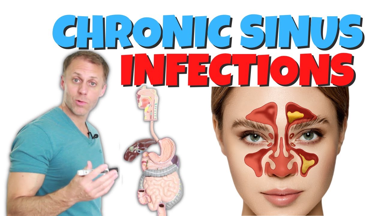 Surprising Connection for Chronic Sinus Infections
