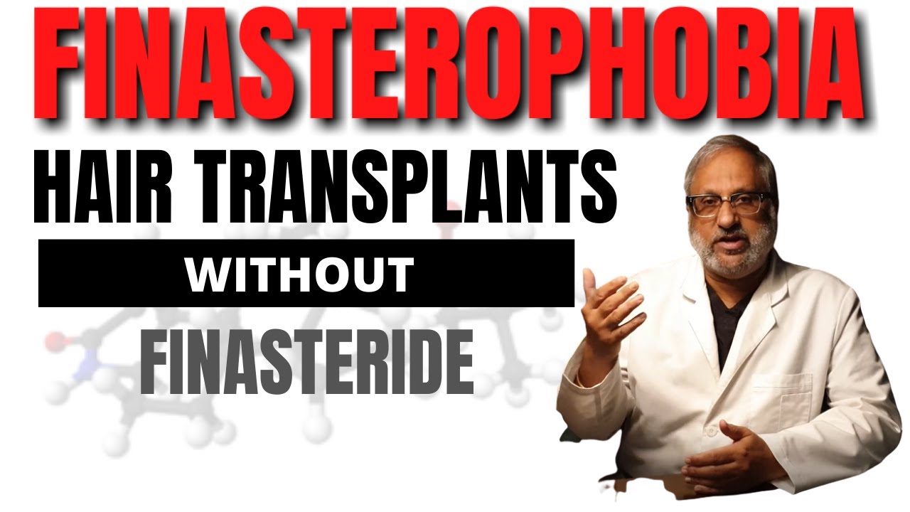Finasteride & Hair transplant | My Comprehensive Guide for those with Finasterophobia