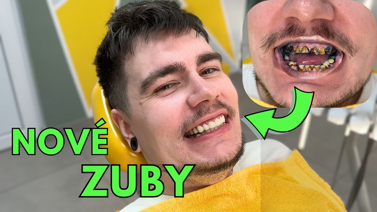Ušetrili sme tisícky eur za nové zuby - NIE V TURECKU!