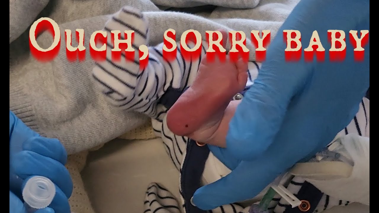 Heelprick blood sampling on baby