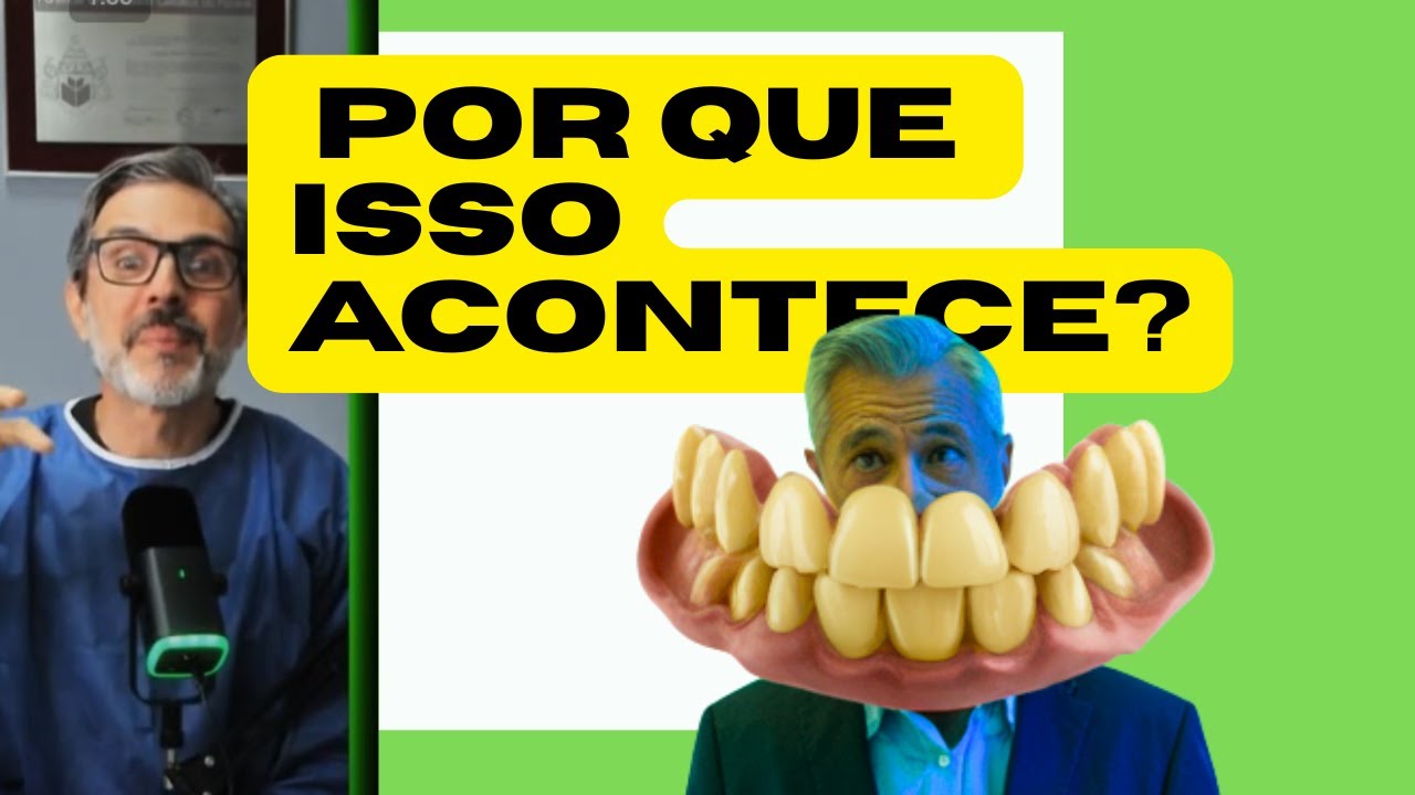 O LADO SUJO da PRÓTESE PROTOCOLO: O que os Dentistas NÃO Contam?