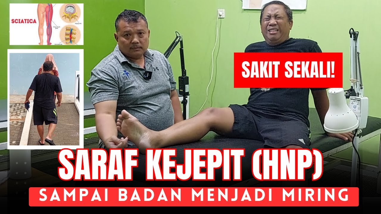 SARAF KEJEPIT (HNP) SAMPAI BADAN MENJADI MIRING SAKIT SEKALI