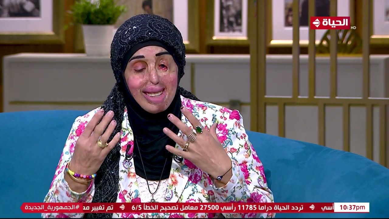 قصة توجع القلب💔أم وبنتها عاشوا اللي محدش يقدر يستحمله  بعد ما الزوج رمى عليهم مية نار