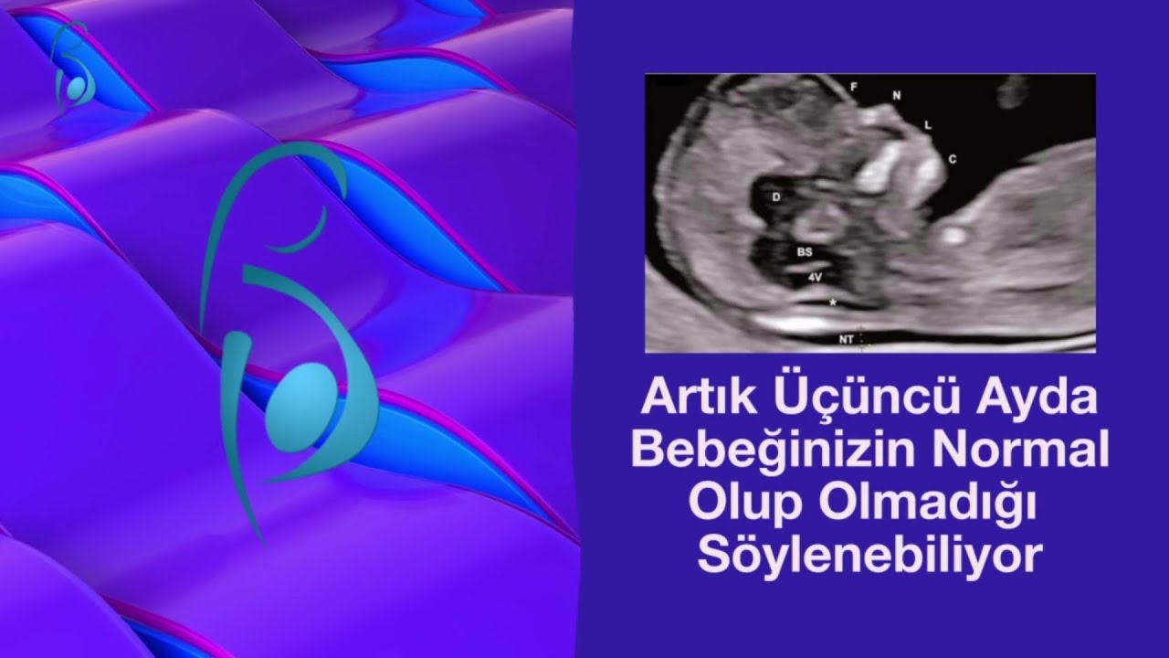 Artık &Uuml;&ccedil;&uuml;nc&uuml; Ayda Bebeğinizin Normal Olup Olmadığı S&ouml;ylenebiliyor- Prof. Dr. Cihat Şen