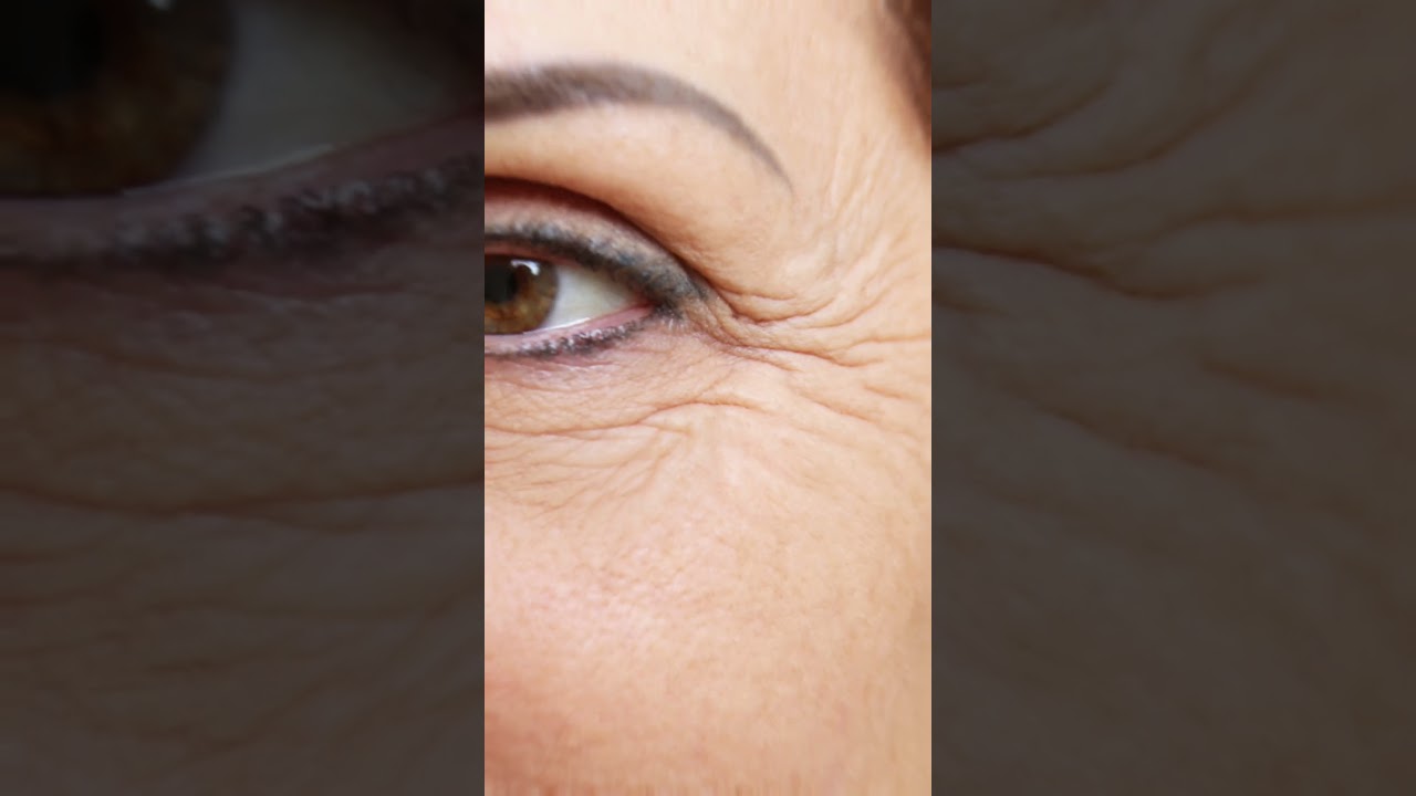 Wrinkles removal home remedy / anti aging foods