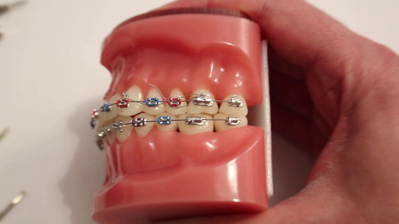 Broken long wire (ligature)