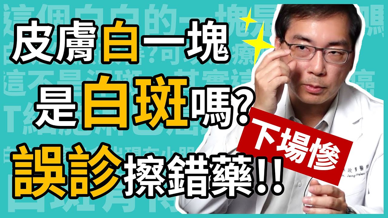 臉白白一塊，是長白斑嗎？誤診擦錯藥，下場超慘！皮膚科林政賢醫師教你打破白斑迷思，揮別惱人白斑！