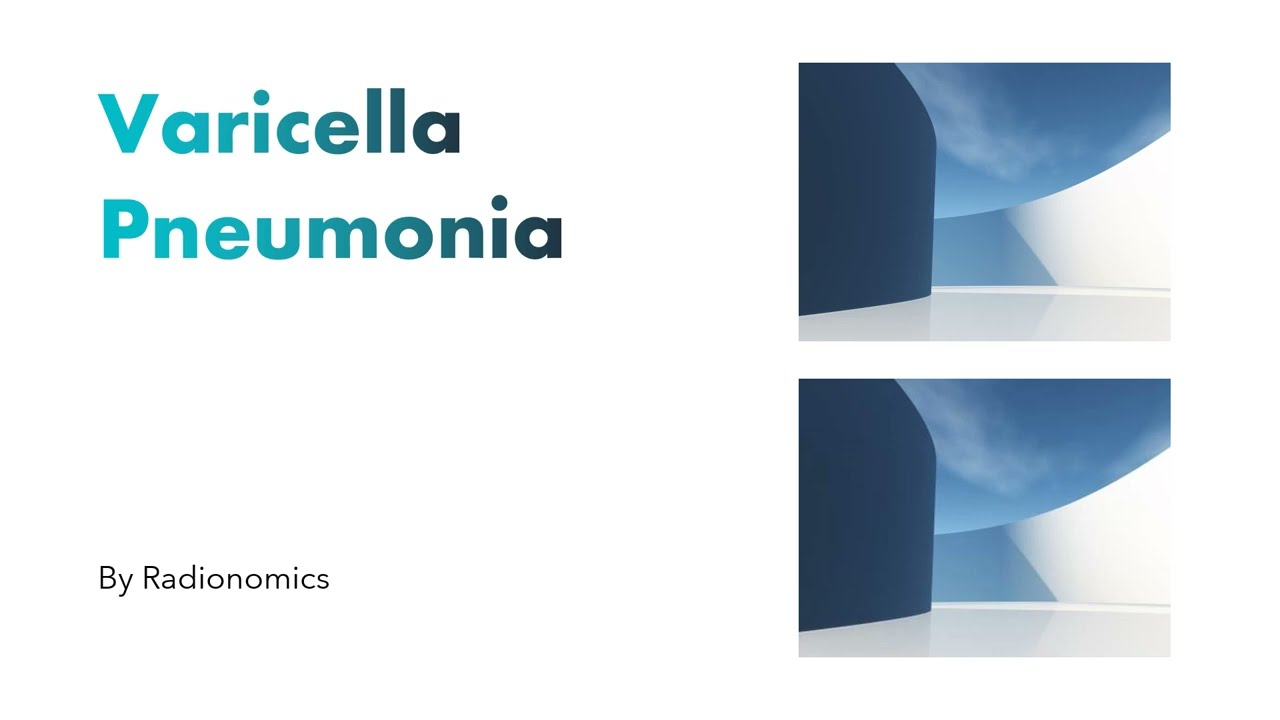Varicella Pneumonia